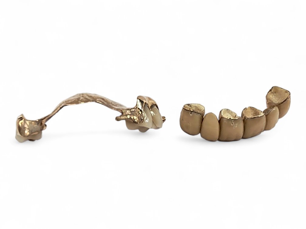 Yellow Gold Dental Appliances — 24.13 g Gross