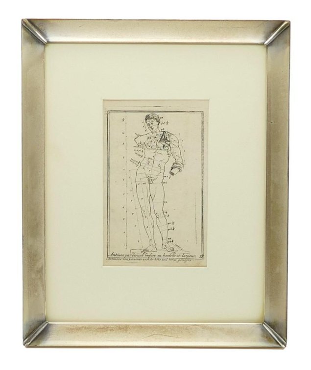 Late 18th Century Medical Engraving