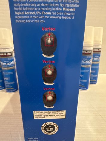 Image for Hair Regrowth treatment