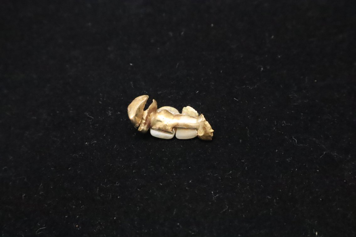Possible Gold