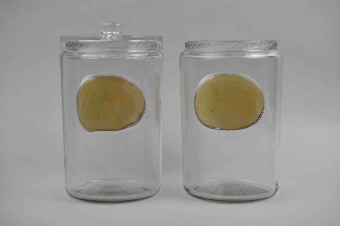 Medical Apothecary Jars, photo 3 of 11
