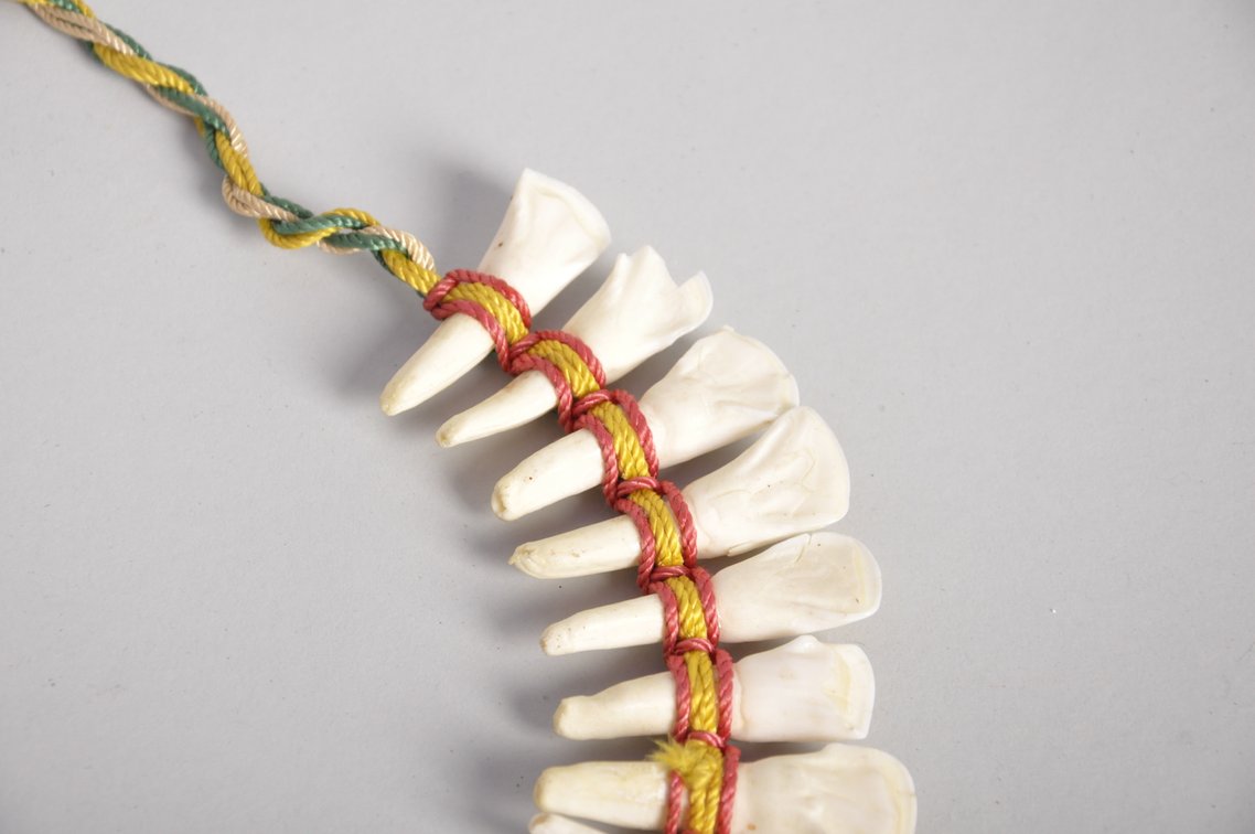 Buffalo Teeth, Beaded, and Stone Necklaces, photo 4 of 8