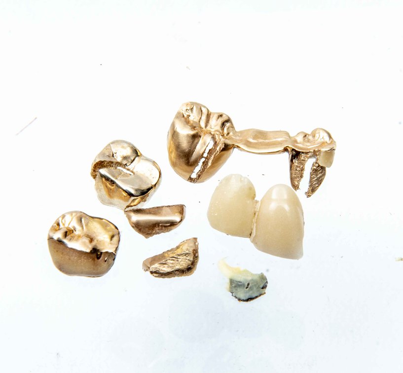 Dental Gold- 17.65 grams