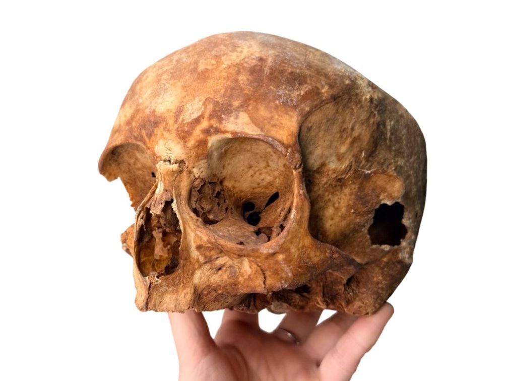 Genuine Human Skull