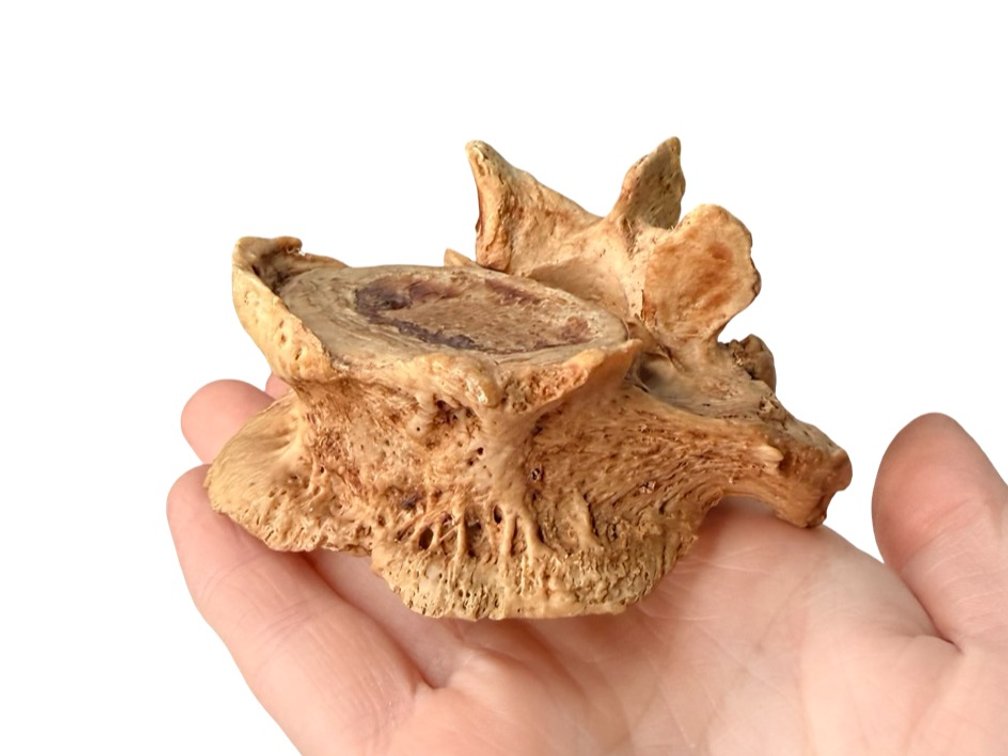 Human Vertebrae Specimen