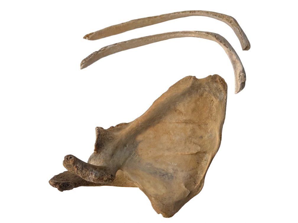 Human Scapula and Rib Bone Specimens