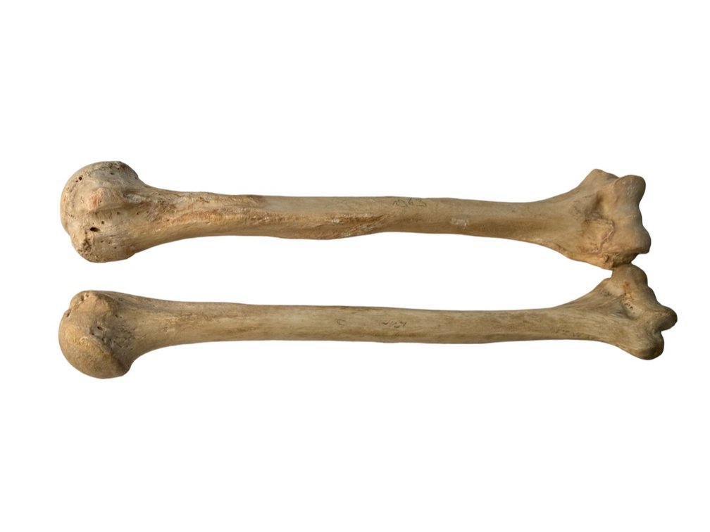 Human Humerus Bones