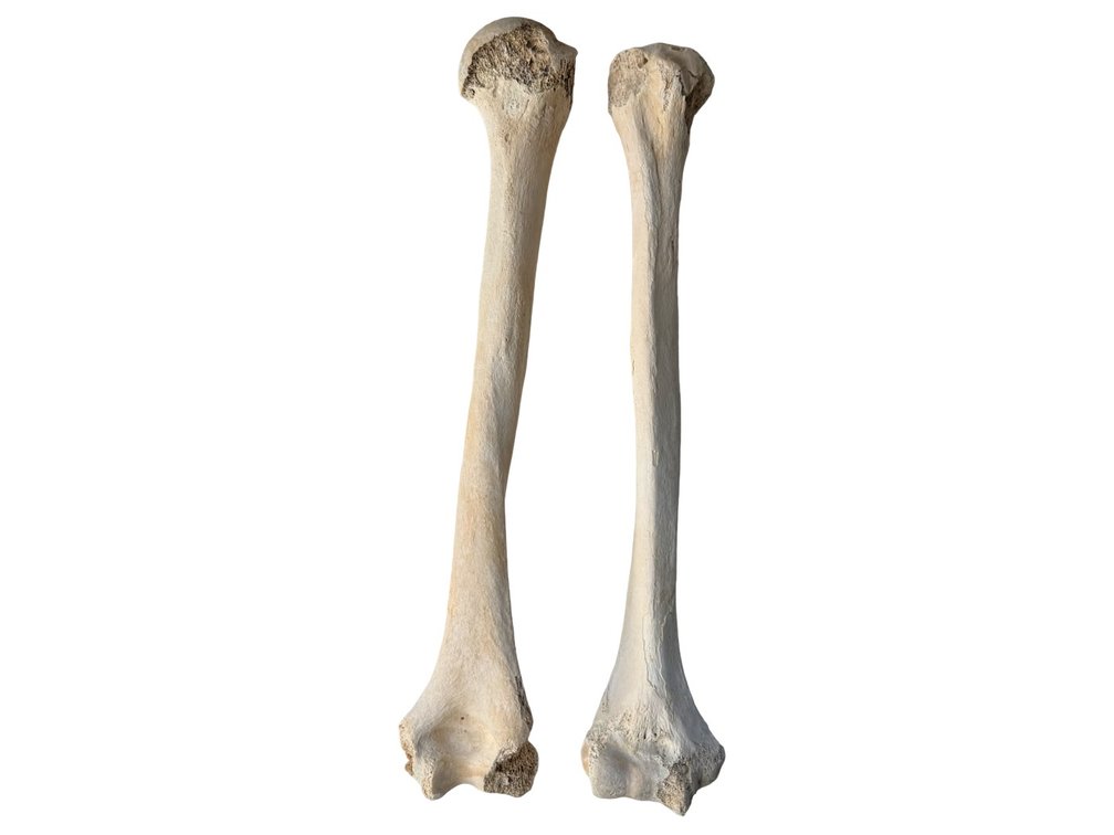 Human Skeletal Bone