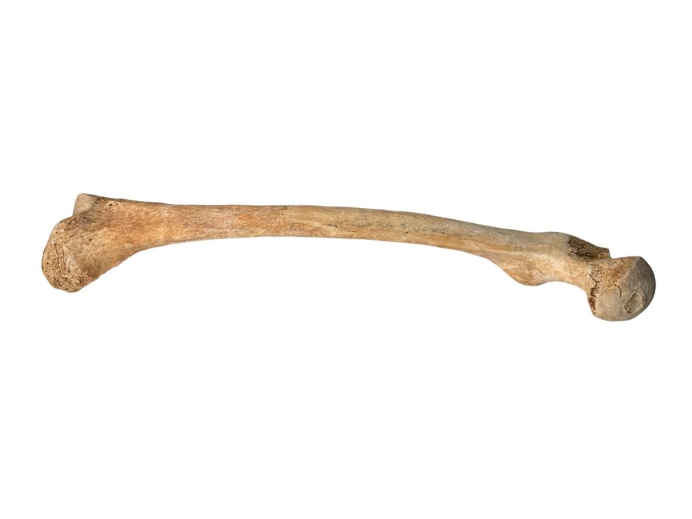 Human Femur