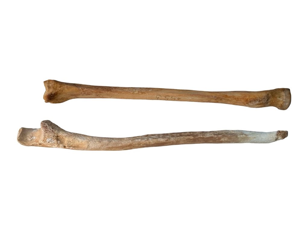 Human Skeletal Forearm Bones