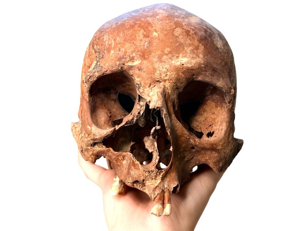 Genuine Human Skull