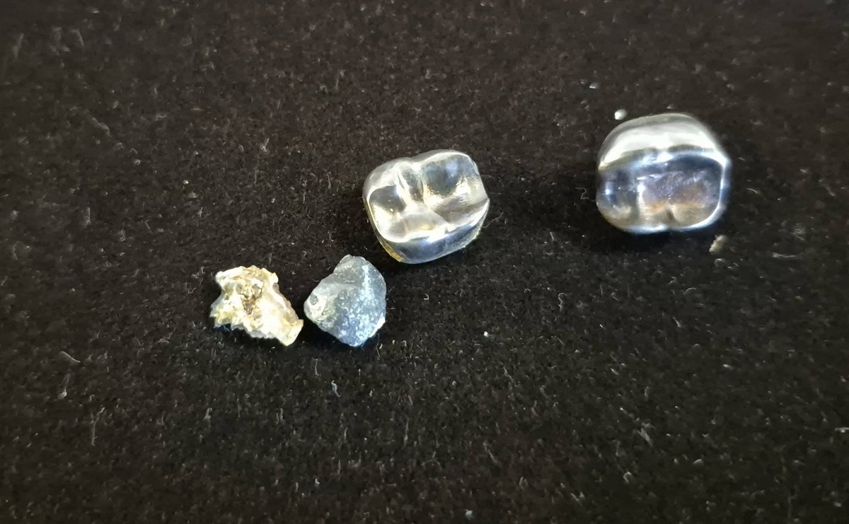 Dental Crowns and Tooth Fragments Lot